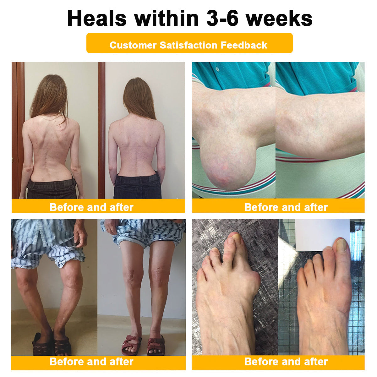 LOVILDS™ Botulinum Toxin & Bee Venom Pain-Relief Bone Healing Cream