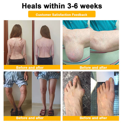 LOVILDS™ Botulinum Toxin & Bee Venom Pain-Relief Bone Healing Cream
