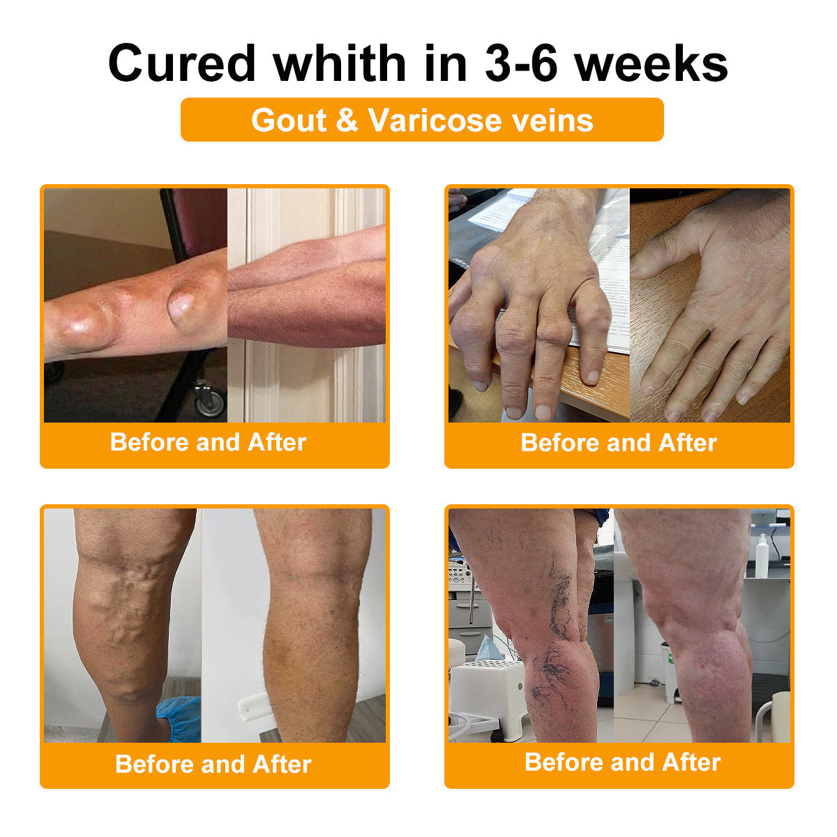 LOVILDS™ Botulinum Toxin & Bee Venom Pain-Relief Bone Healing Cream