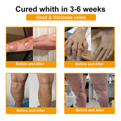 LOVILDS™ Botulinum Toxin & Bee Venom Pain-Relief Bone Healing Cream