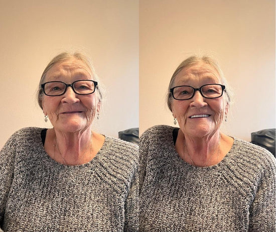 🦷NESLEMY™🦷 Natural Fit Full Denture Set（✅ Clinically backed comfort-fit dentures — Trusted for all-day comfort.）