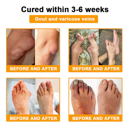 AQA™ Botulinum Toxin & Bee Essence Pain-Relief Bone Healing Cream