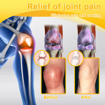 LOVILDS™ Botulinum Toxin & Bee Venom Pain-Relief Bone Healing Cream